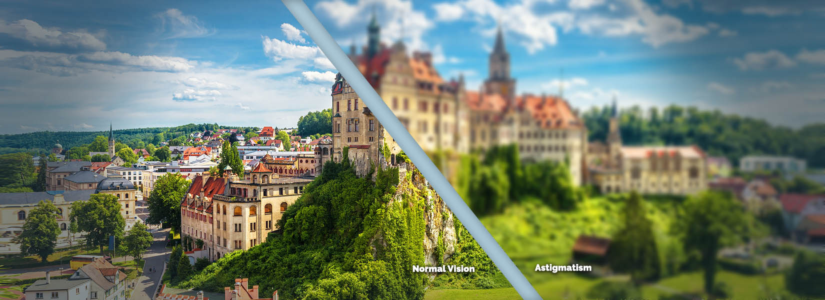 Astigmatism Treatment in Far North Central