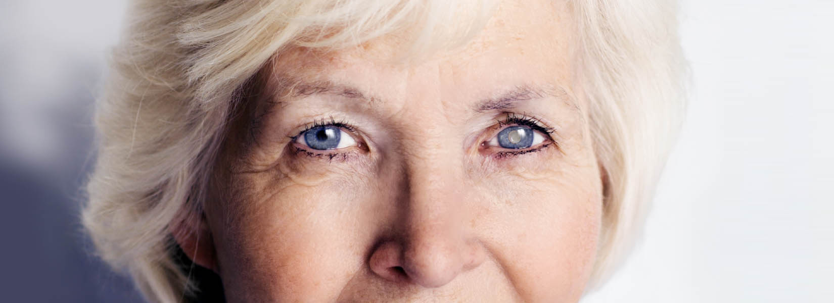 Cataract Surgery in Far North Central